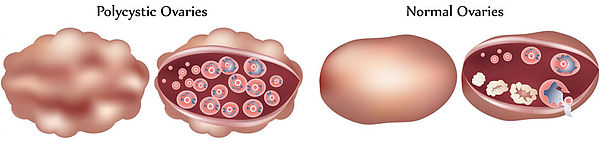 Clínica de Laparoscopía Ginecológica - Tijuana Ginecologist/Ginecologia Tijuana, Dr. Daniel Sánchez, ginecologos, laparoscopy, infertilidad, infertility, ginecology