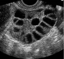 Clínica de Laparoscopía Ginecológica - Tijuana Ginecologist/Ginecologia Tijuana, Dr. Daniel Sánchez, ginecologos, laparoscopy, infertilidad, infertility, ginecology